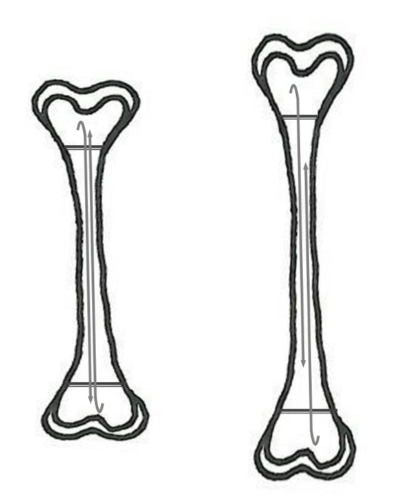 Las dos agujas deslizan una sobre la otra con el crecimiento del hueso 