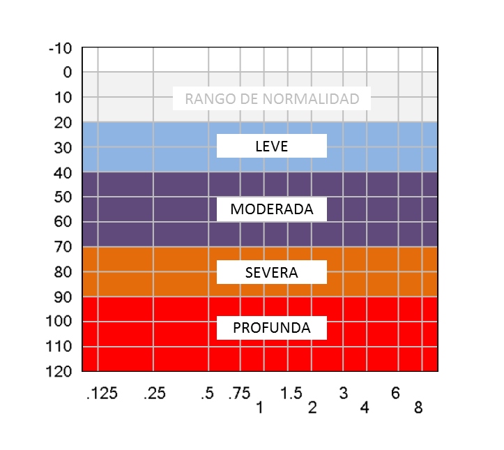 Grados de hipoacusia 