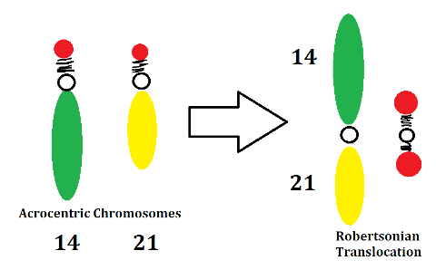 Translocación robertsoniana