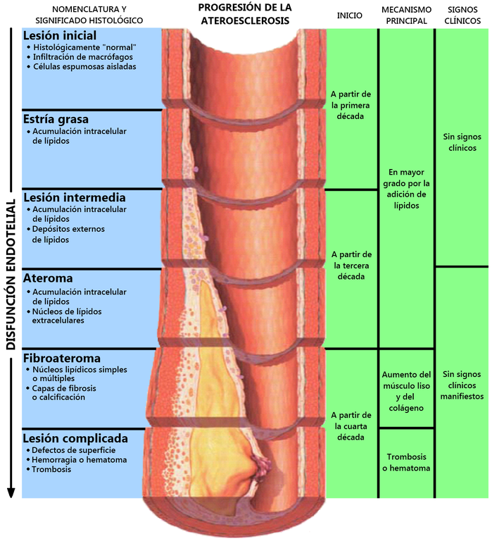 Progresión de la aterosclerosis