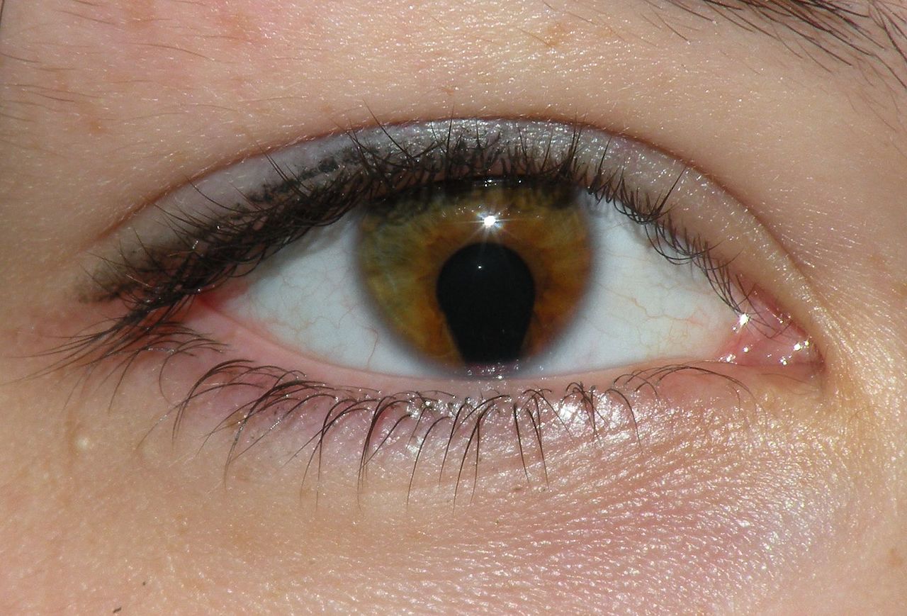 Coloboma iris