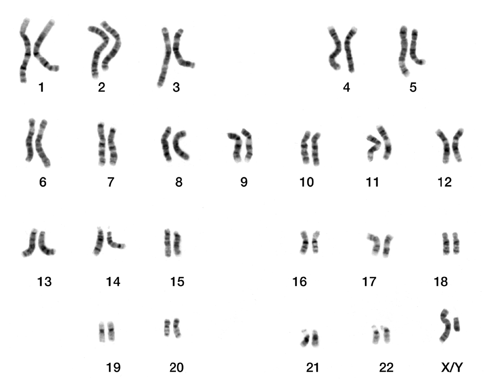 Cariotipo cromosomas