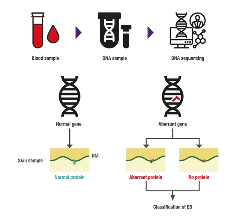 EB diagnosis lab tests