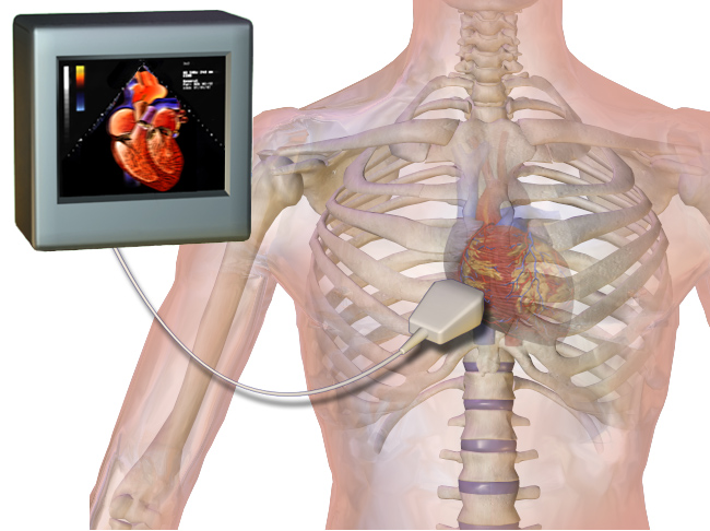 Ecocardiograma