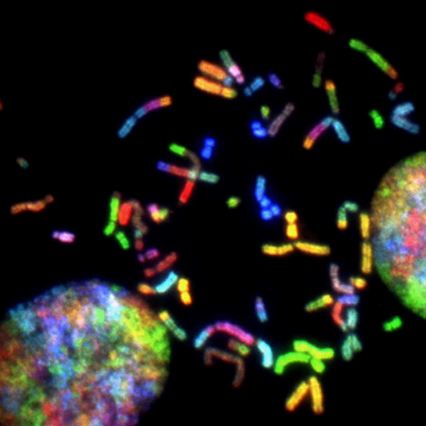 Caryotype chromosomes