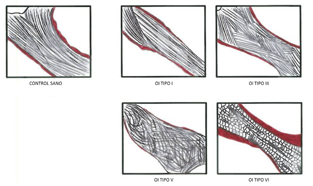 Fibras de colágeno observadas al microscopio con luz polarizada 