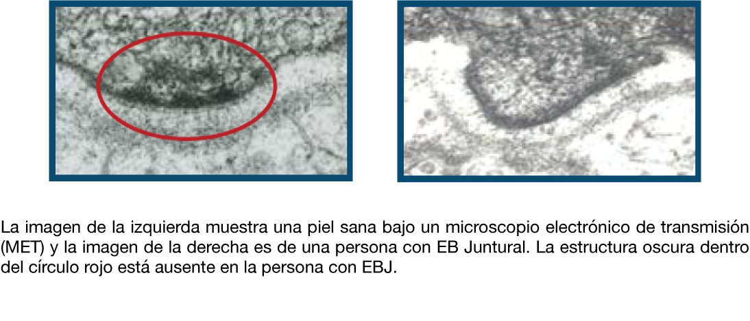 Microscopía electrónica de transmisión 