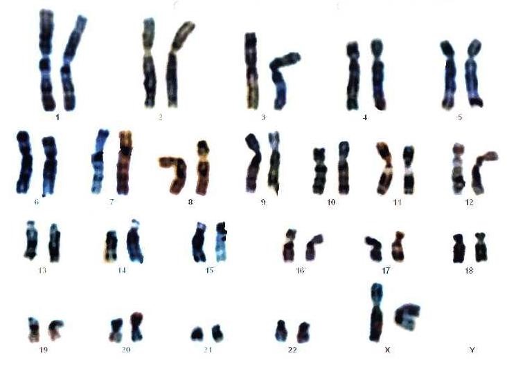 Cariotipo cromosomas