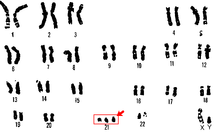 Que Es Cromosoma Numericas Que Es Cromosoma Numericas