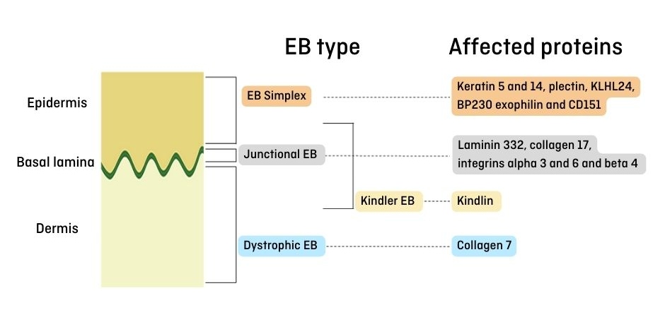 types of epidermolysis bullosa