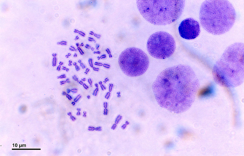 Cromosomas humanos al microscopio