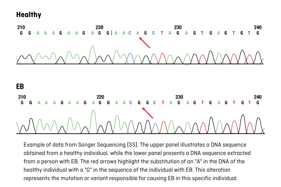 Sanger sequencing DNA EB