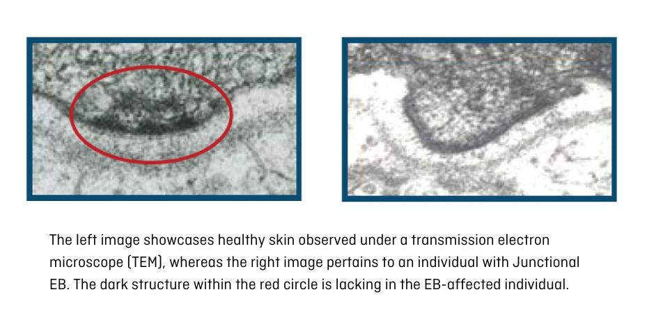 transmission electron microscopy