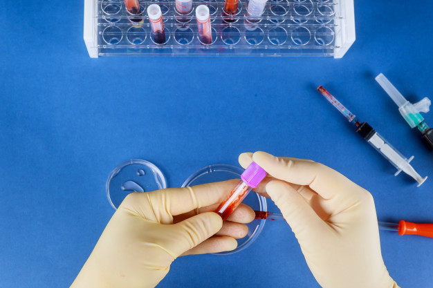 Person manipulating blood samples in the lab