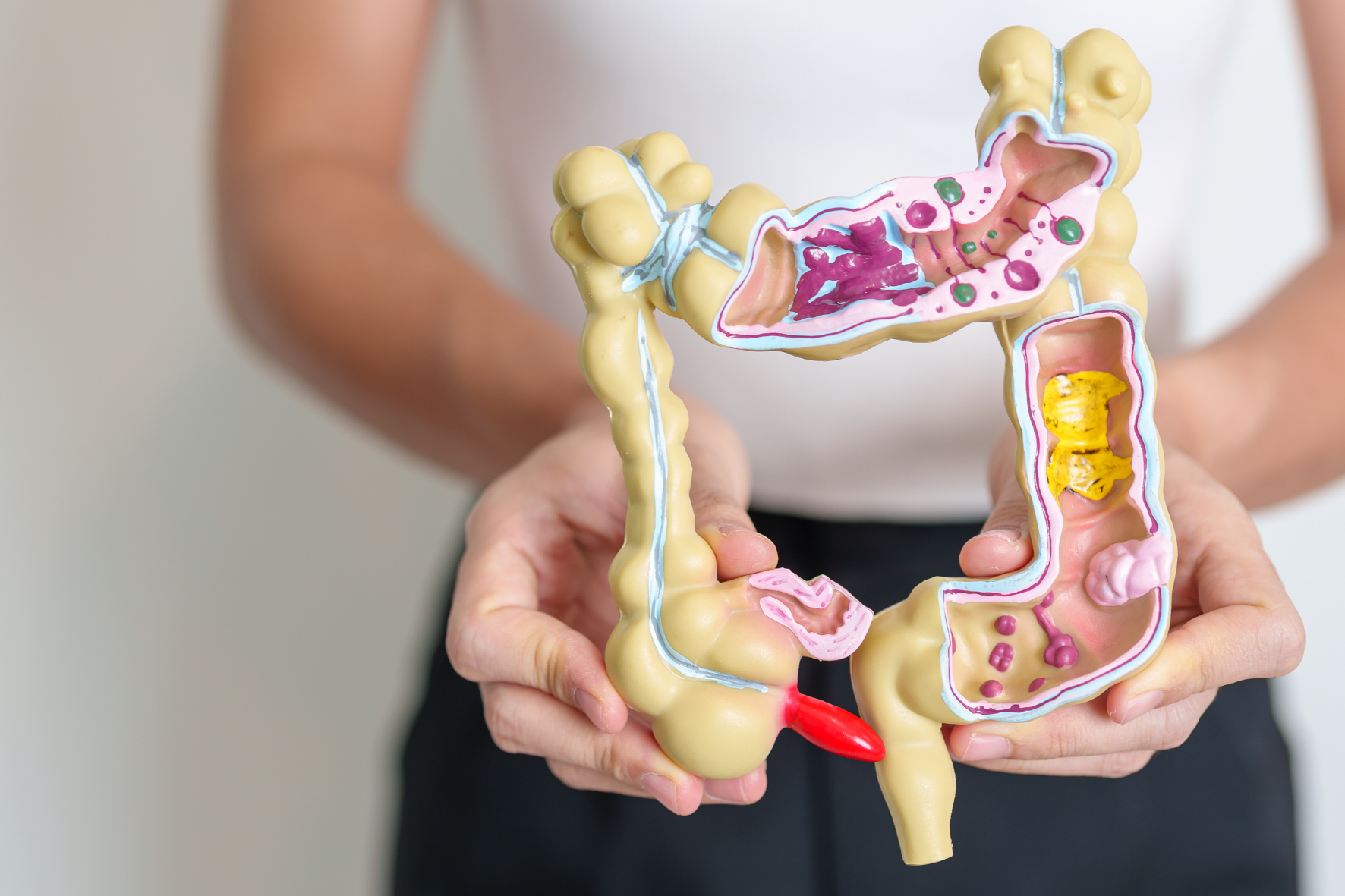foto maqueta colon