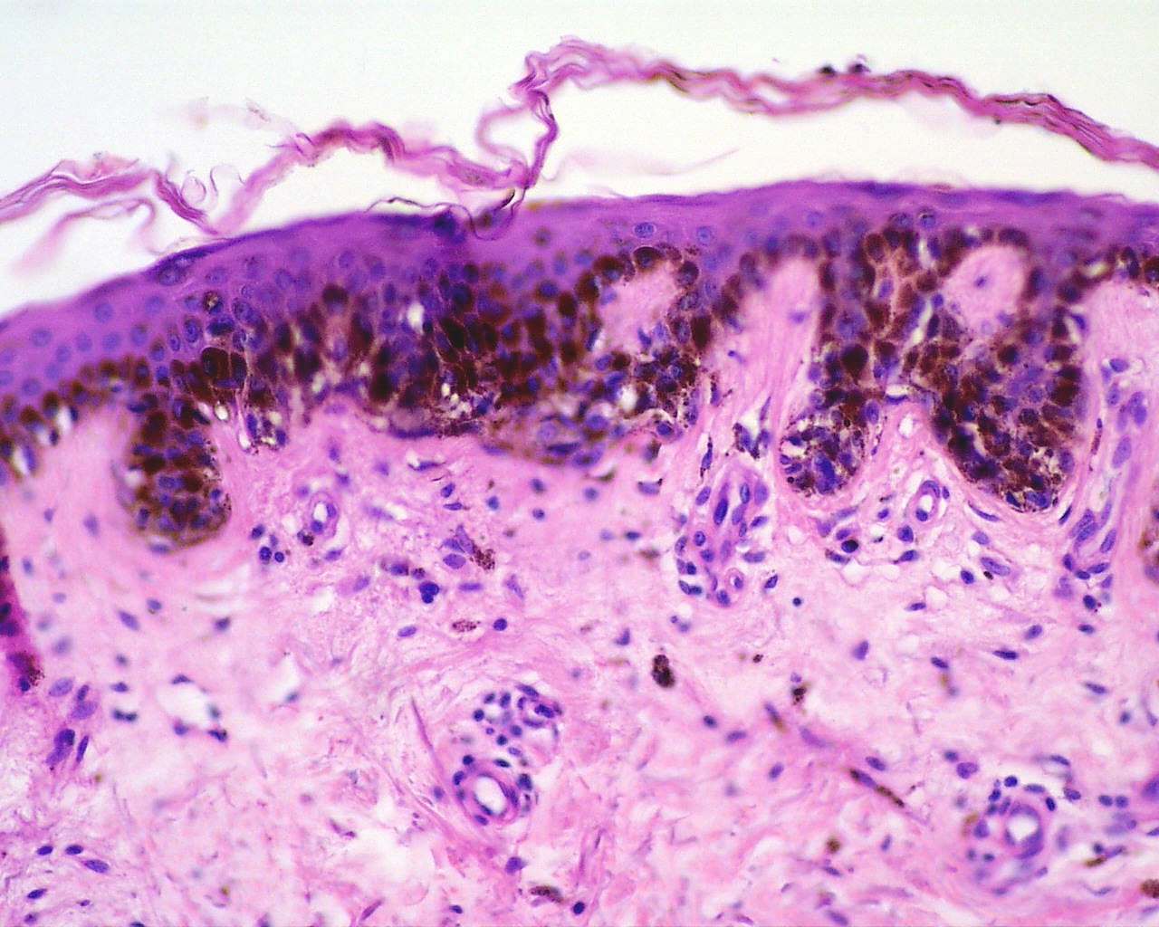 Skin tissue under the microscope. Wikimedia