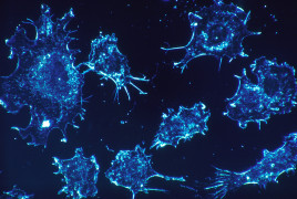 Cancer cells_microscopy