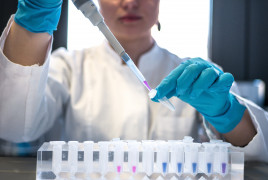 Woman a pipette in a lab