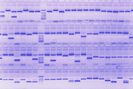 Agarose gel Coomasie