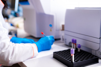 Researcher Researcher
