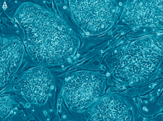 Gene and cell therapy Gene and cell therapy
