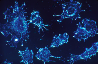 Cancer cells Cancer cells