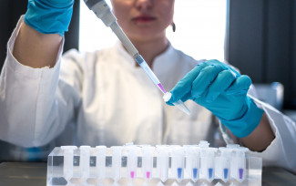 Researcher pippettes samples in a laboratory Woman a pipette in a lab