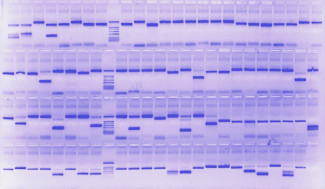 Agarose gel Coomasie Agarose gel Coomasie