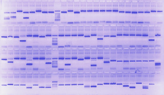 Agarose gel Coomasie