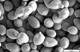 Saccharomyces cerevisiae imagen microscopio