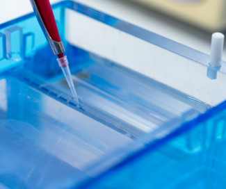 Gel agarosa genética molecular Gel agarosa genética molecular