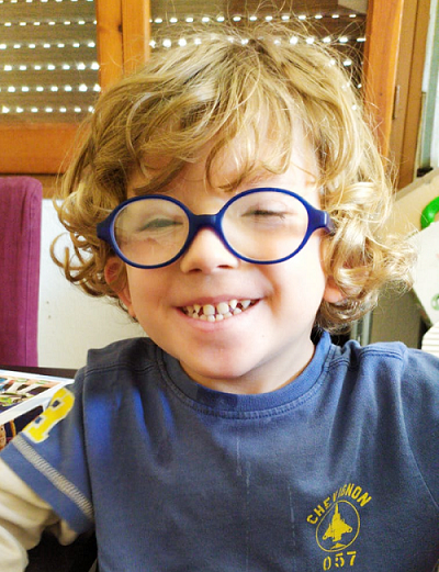 When Edu was born he could not open his eyelids, but doctors did not find that a reason for not discharging him from hospital.