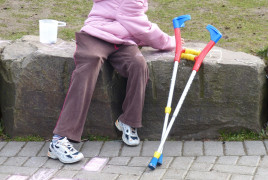 Child with crutches